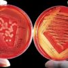 Bacteria