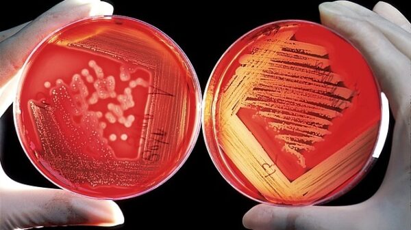 Bacteria